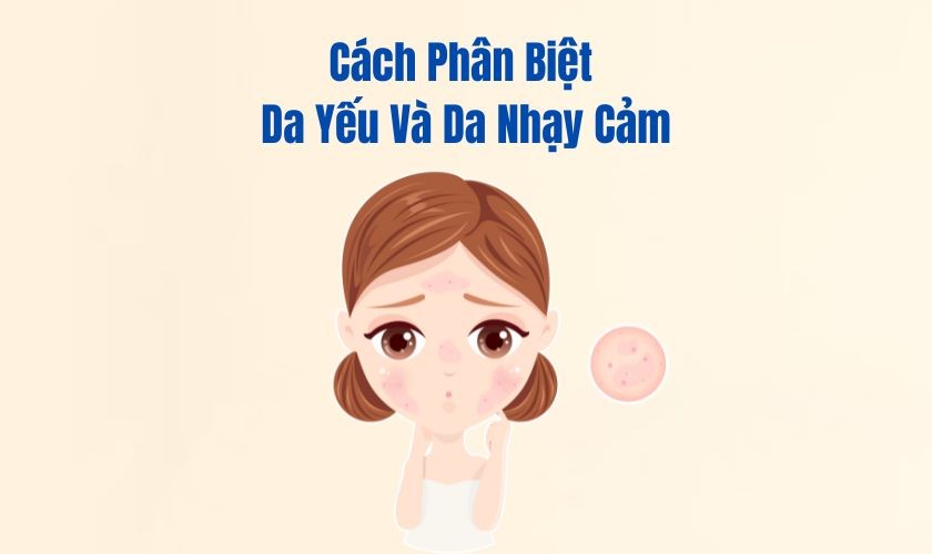 Cách Phân Biệt Da Yếu Và Da Nhạy Cảm – Đừng Nhầm Nếu Không Muốn Da Ngày Càng Tệ