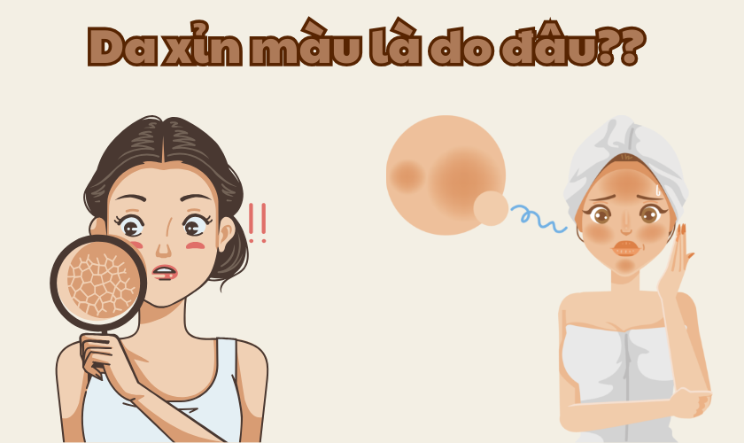 Da xỉn màu do đâu? Sự thật khiến 90% skincare sai cách