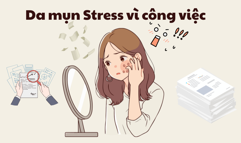 Da mụn vì stress công việc: Nguyên nhân & Routine Renoskin phục hồi nhanh