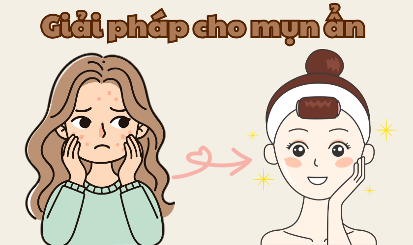 Mụn Ẩn Lâu Năm Không Hết? Giải Pháp Triệt Điểm Với Control Toner & Acne Remover Renoskin