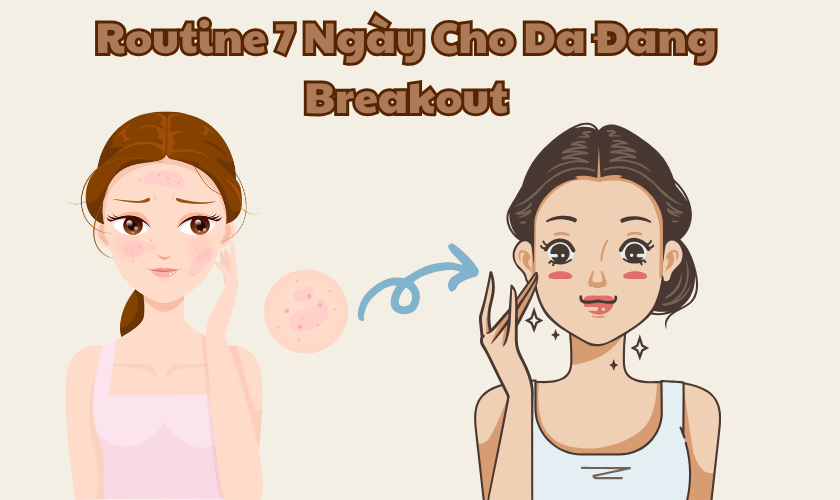 Chuẩn Routine 7 Ngày Cho Da Đang Breakout – Giảm Mụn An Toàn Cùng Renoskin