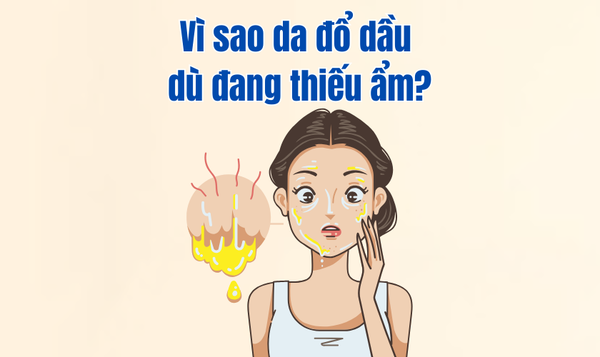 Vì sao da đổ dầu dù đang thiếu ẩm?