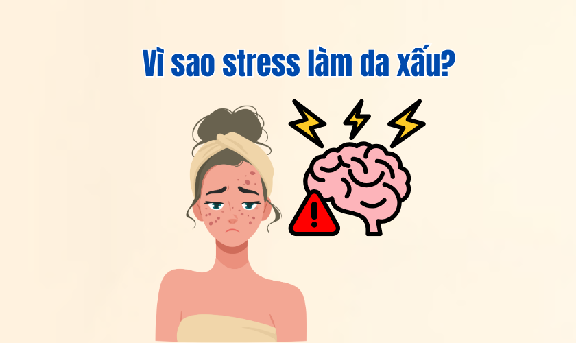 Vì sao stress làm da xấu?
