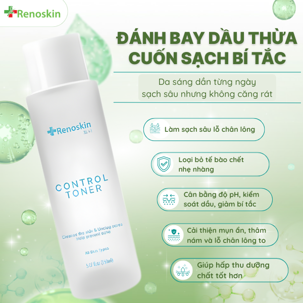 Control Toner Renoskin hỗ trợ trị mụn ẩn, giảm thâm và se nhỏ lỗ chân lông