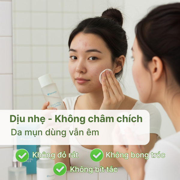 Toner acid Control Toner Renoskin làm sạch sâu, loại bỏ tế bào chết và kiểm soát dầu thừa cho da sáng mịn.