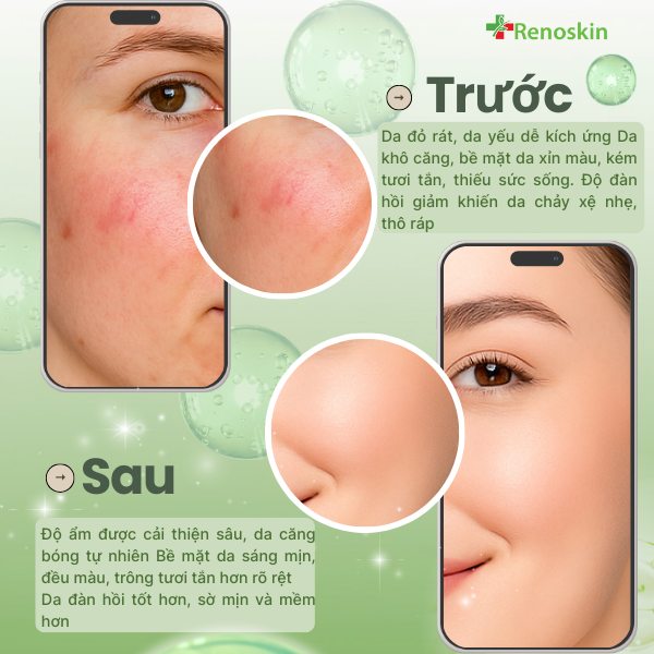 Lotion massage Renoskin HA Collagen – công nghệ Hanacos Hàn Quốc, dung tích 200ml, an toàn cho da