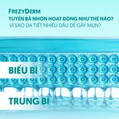 TUYẾN BÃ NHỜN HOẠT ĐỘNG NHƯ THẾ NÀO? VÌ SAO DA TIẾT NHIỀU DẦU DỄ GÂY MỤN?