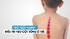 Cách Chữa Gù Lưng Cho Bé Hiệu Quả