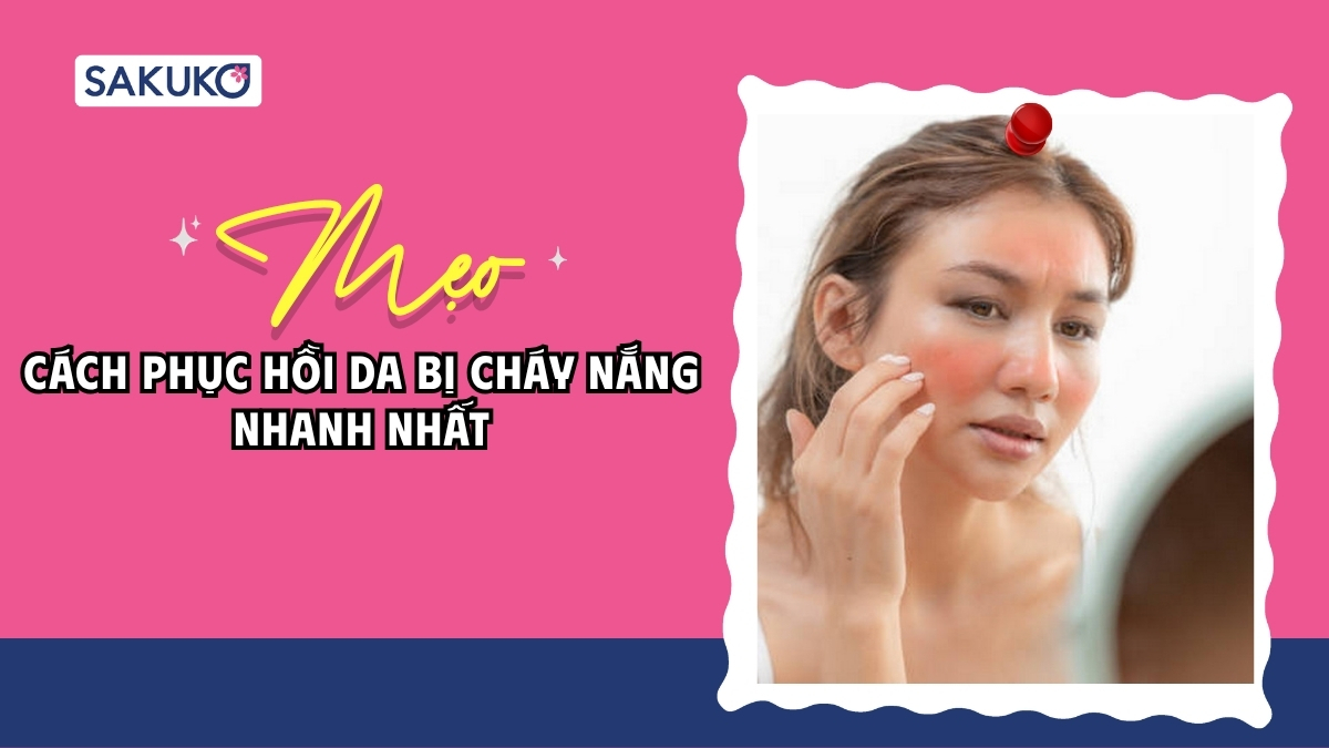 4 cách phục hồi da bị cháy nắng nhanh nhất bằng nguyên liệu tự nhiên
