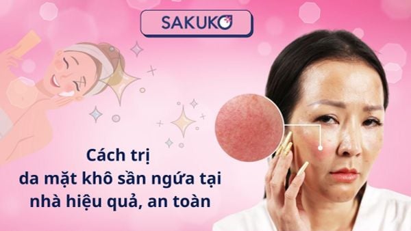 Cách trị da mặt khô sần ngứa tại nhà hiệu quả, an toàn