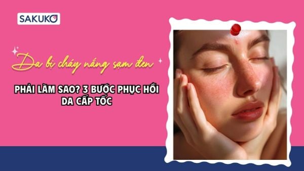 Da bị cháy nắng sạm đen phải làm sao? 3 bước phục hồi da cấp tốc