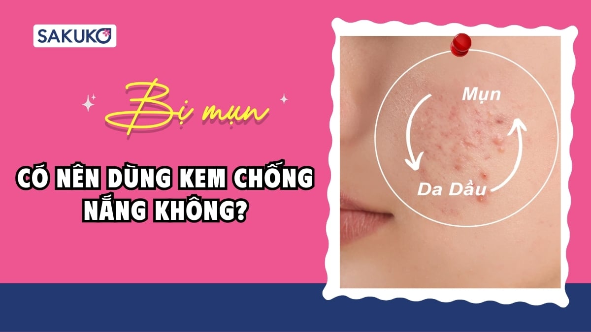 Da dầu mụn nên dùng kem chống nắng nào? Top 10 sản phẩm kiềm dầu hiệu quả