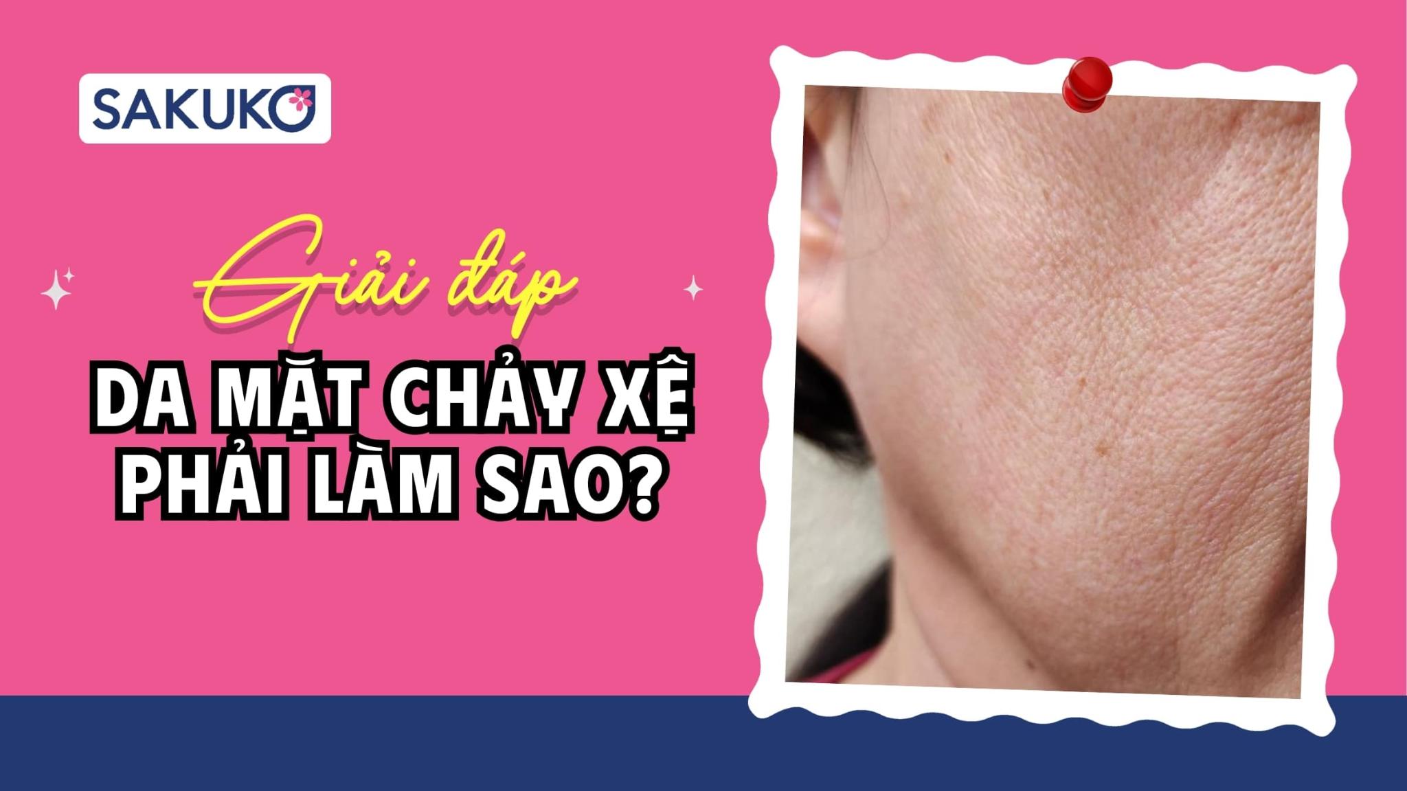 Da mặt chảy xệ phải làm sao? 10+ giải pháp tối ưu, nhanh chóng