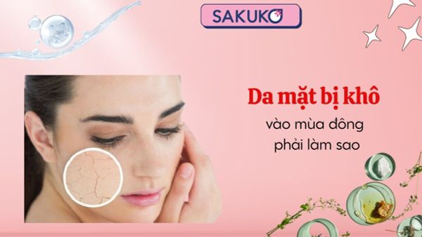 Da mặt bị khô vào mùa đông phải làm sao để không bị bong tróc