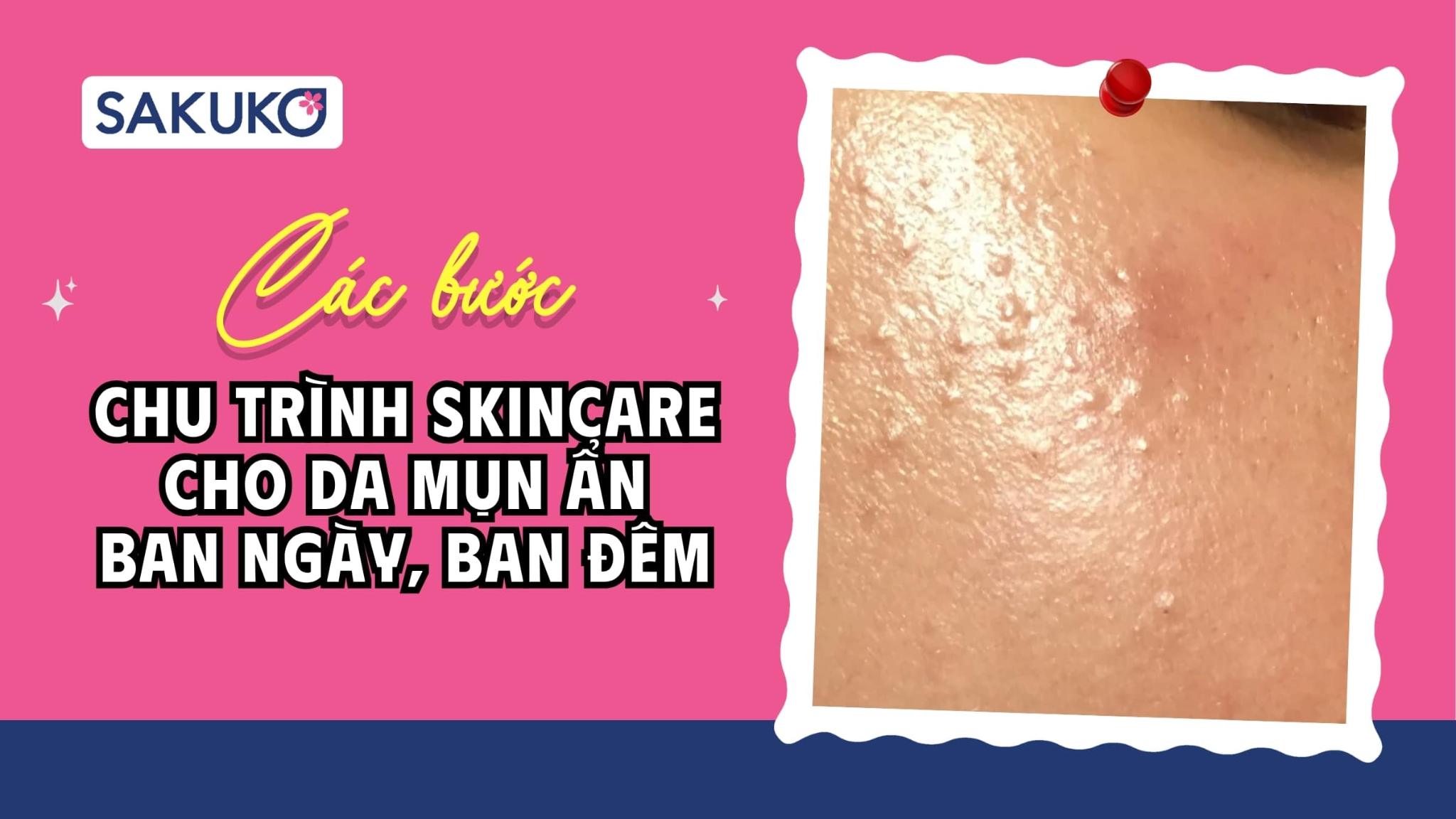 [A-Z] Chu trình skincare cho da mụn ẩn vào ban ngày, ban đêm