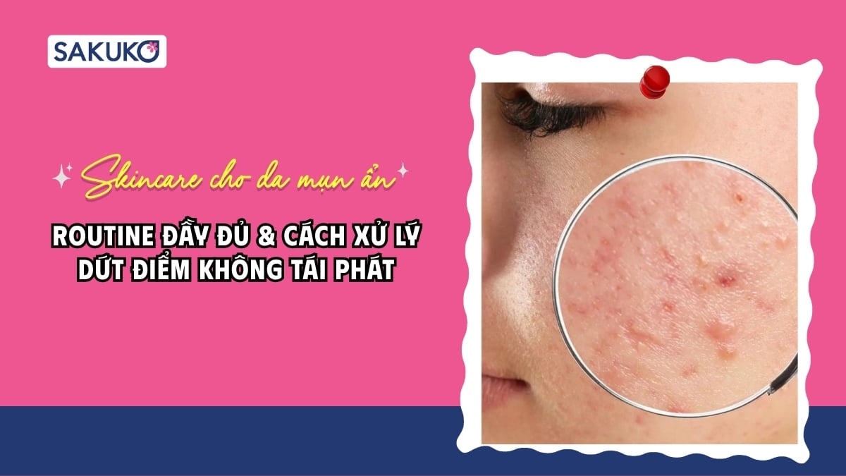 Skincare cho da mụn ẩn: Routine đầy đủ & cách xử lý dứt điểm không tái phát