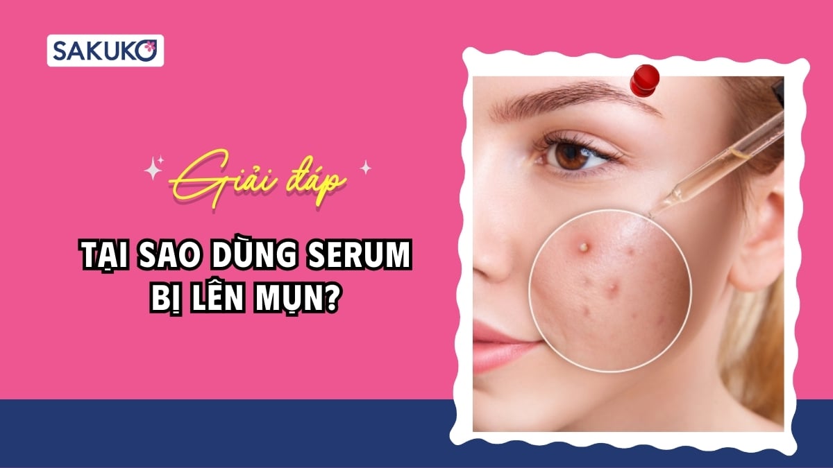Tại sao dùng serum bị lên mụn? Nguyên nhân & cách khắc phục