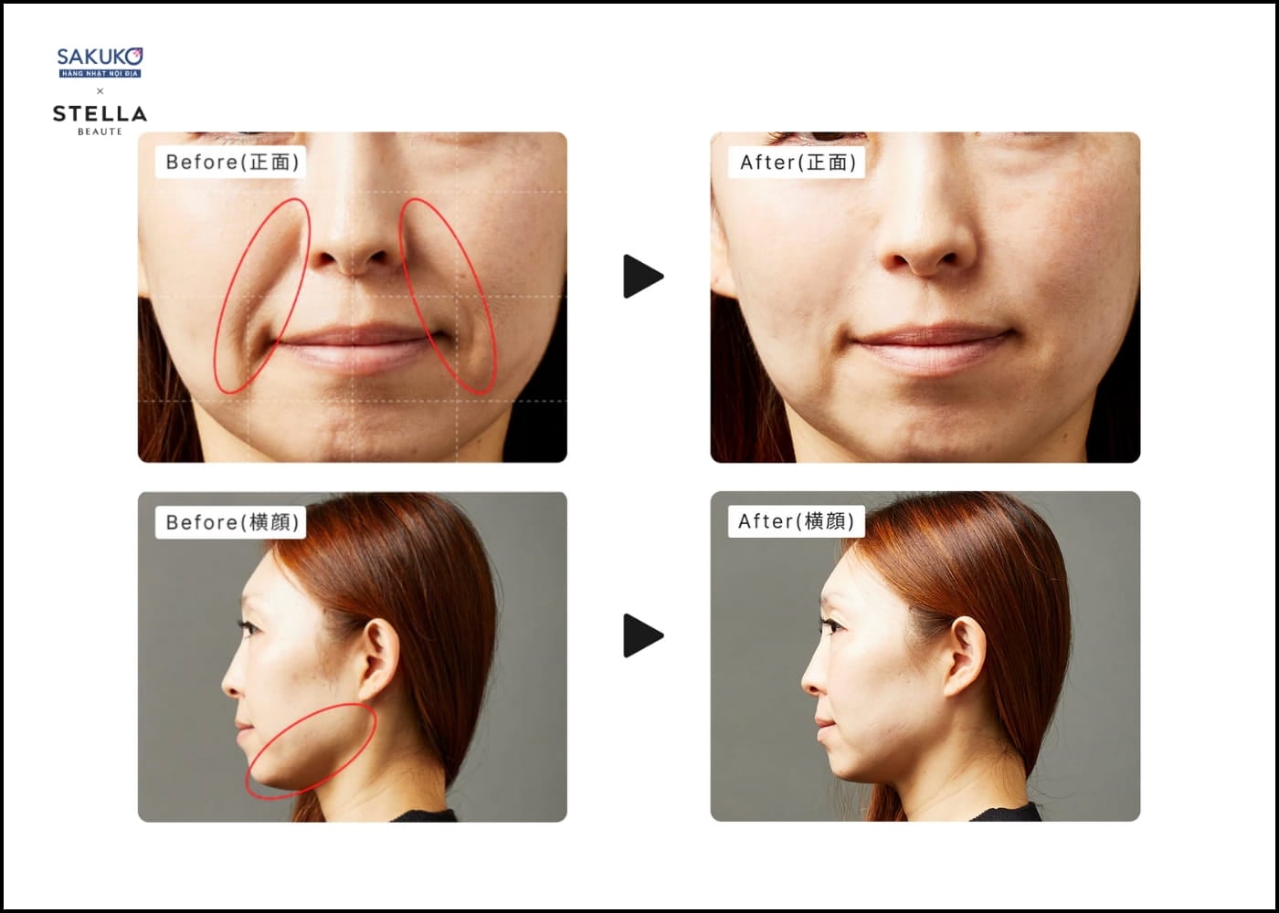 Hiệu quả thực tế của bút massage nâng cơ Stella Beaute Stick