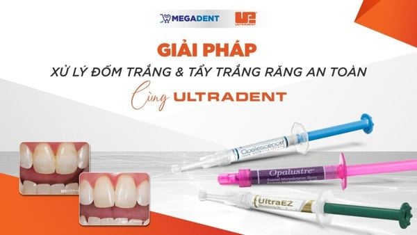 Giải pháp xử lý đốm trắng & tẩy trắng răng an toàn cùng Ultradent