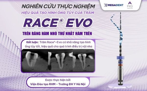 Trâm nội nha Race EVO