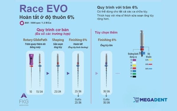 Quy trình cơ bản khi sử dụng trâm nội nha Race EVO độ thuôn 6%