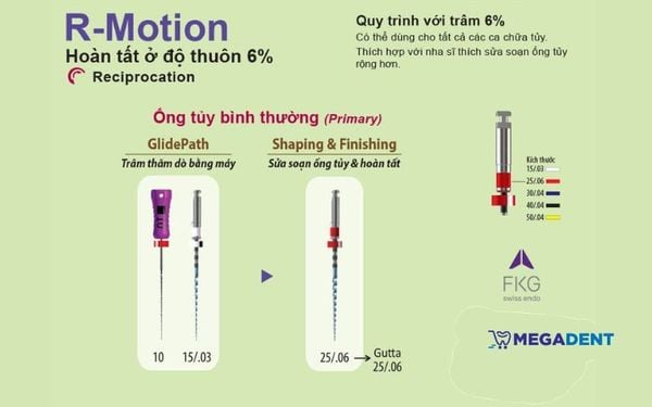 trâm nội nha R-Motion hoàn tất ở độ thuôn 6%