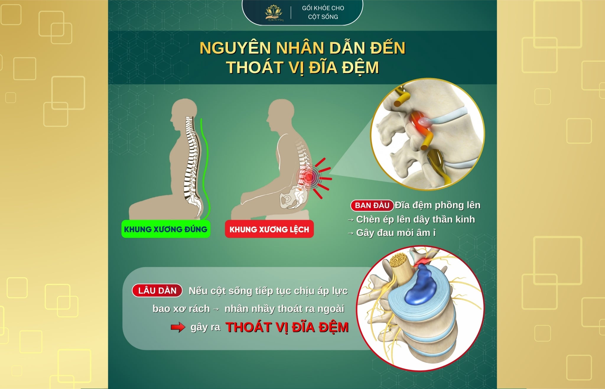 NGUYÊN NHÂN DẪN ĐẾN 