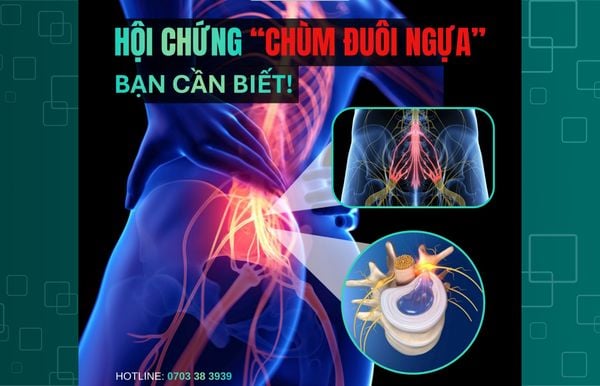 HỘI CHỨNG CHÙM ĐUÔI NGỰA: NGUYÊN NHÂN, DẤU HIỆU CẢNH BÁO VÀ HƯỚNG PHÒNG TRÁNH