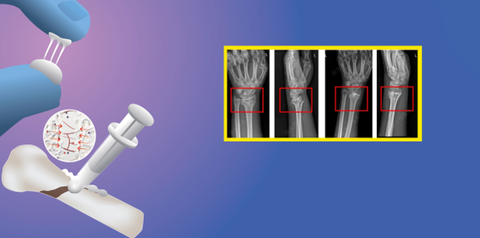 Keo sinh học từ hàu: Đột phá y học của nhóm nhà khoa học Trung Quốc