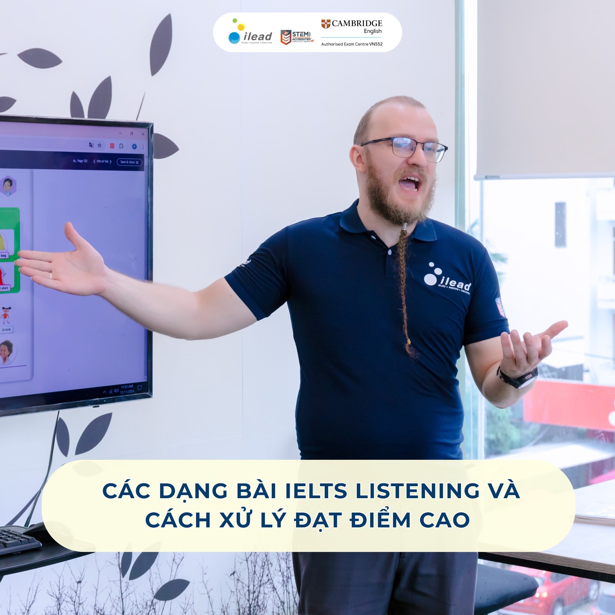Các dạng bài IELTS Listening và cách xử lý đạt điểm cao