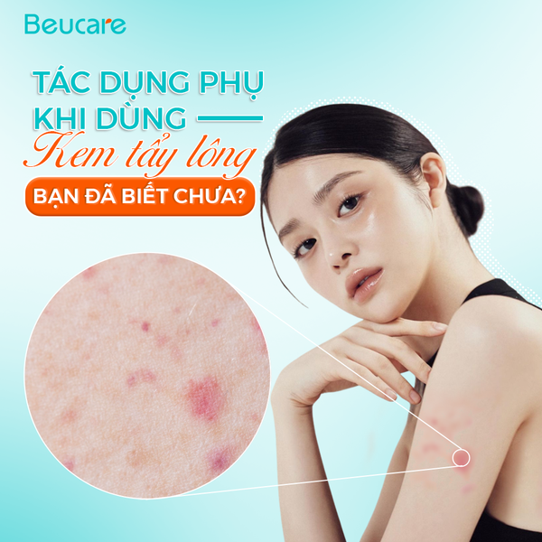 Tác dụng phụ của kem tẩy lông: Cách nhận biết & phòng tránh