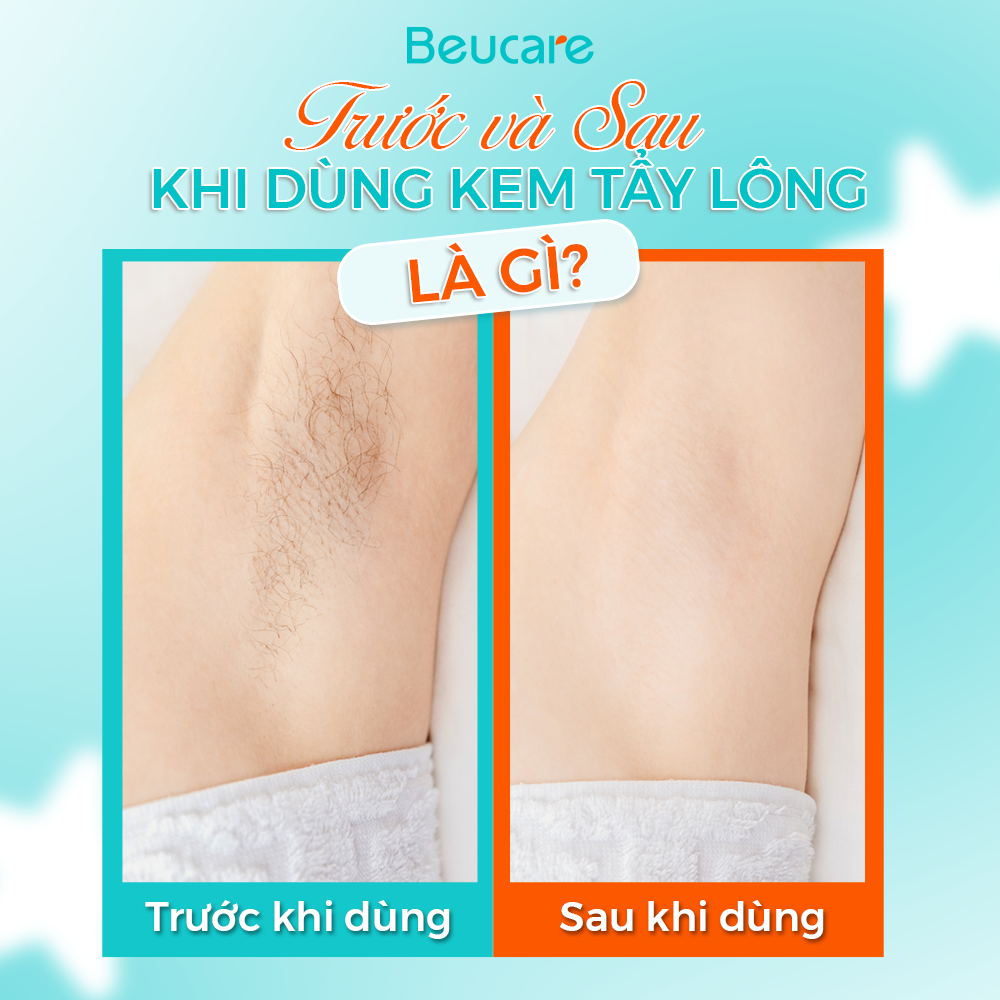 Trước và sau khi dùng kem tẩy lông nên làm gì? Bí quyết vàng cho làn da mịn màng, không kích ứng