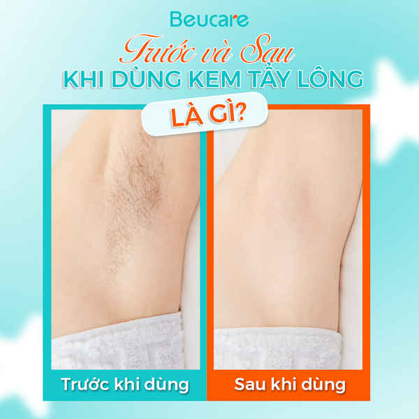 Trước và sau khi dùng kem tẩy lông nên làm gì? Bí quyết vàng cho làn da mịn màng, không kích ứng