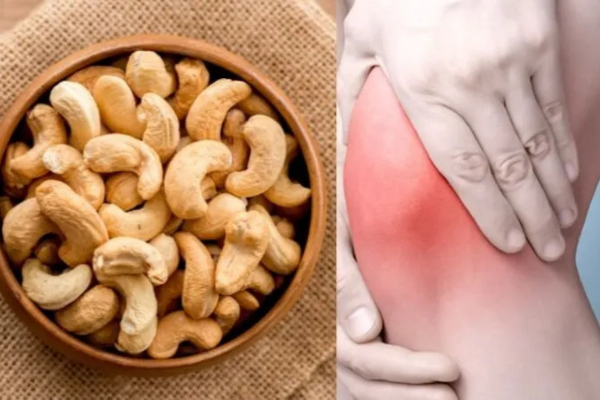 Người bị gout có ăn hạt điều được không?