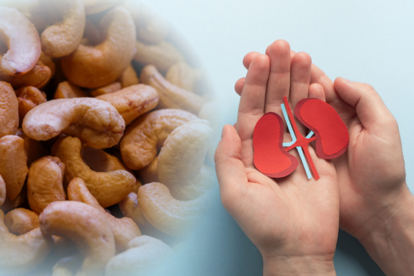 Người bị suy thận thì ăn hạt điều tẩm vị được không?