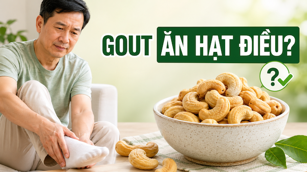 Hạt Điều Cho Người Bị Gout: Ăn Được Không?