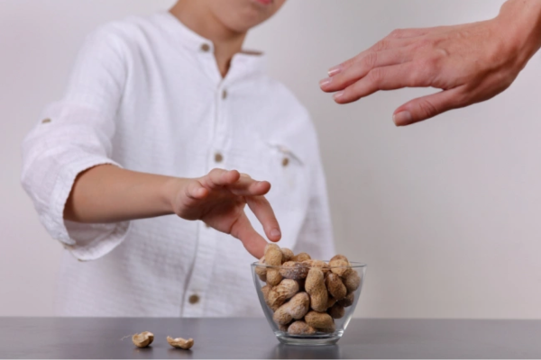 Cách nhận biết dấu hiệu dị ứng hạt điều ở trẻ em