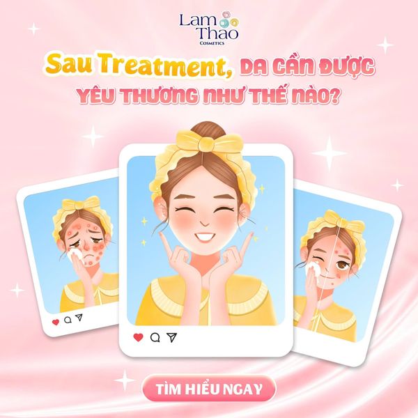 Cách Chăm Sóc Da Sau Treatment An Toàn Và Hiệu Quả