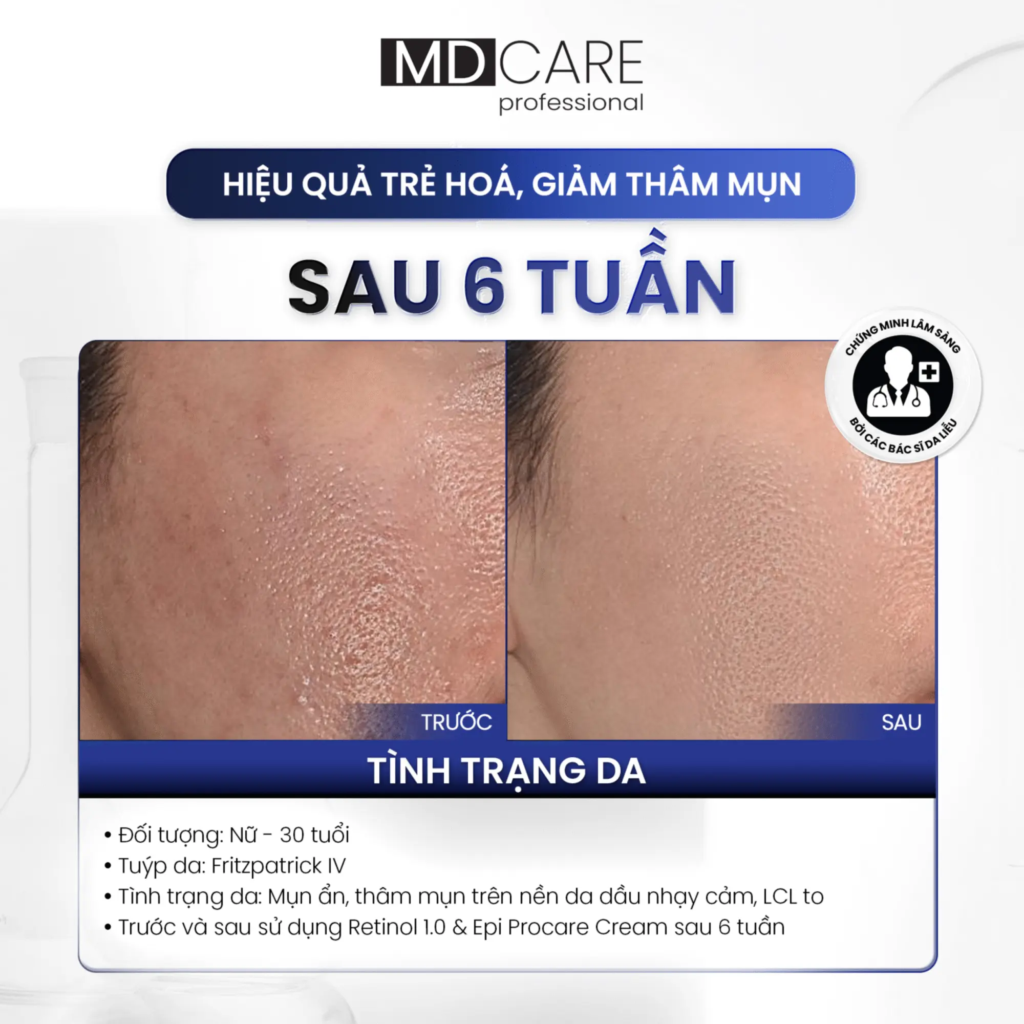 Kem dưỡng sáng da và cải thiện nếp nhăn Pro-Retinol 1.0
