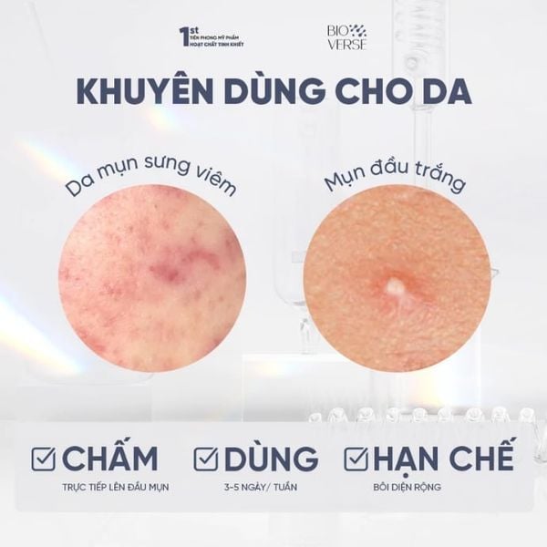 Gel Chấm Mụn Hỗ Trợ Giảm Khuẩn Và Se Còi Mụn Bioverse S311 Succinic Acneout Spot Gel