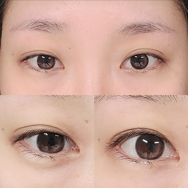 Dán Mí Lưới 60 Miếng Merina