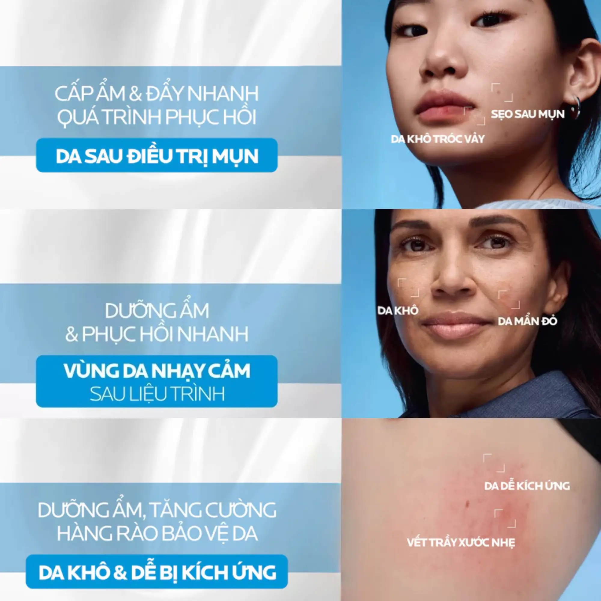 kem dưỡng b5 la_roche-posay