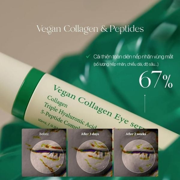 Tinh Chất Dưỡng Mắt Thuần Chay Axis-Y Vegan Collagen Eye Serum