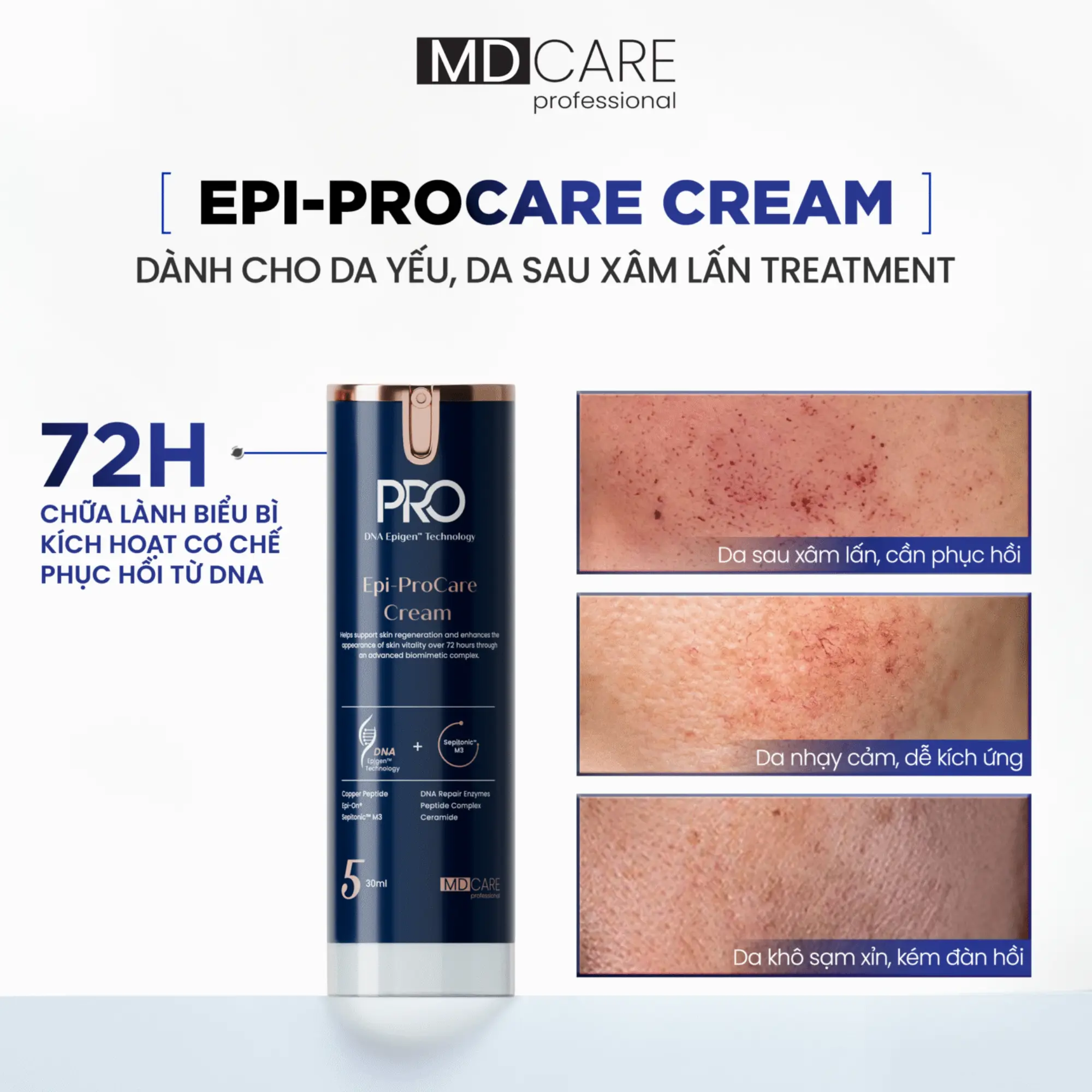 Kem Dưỡng Phục Hồi Và Cải Thiện Nếp Nhăn MD Care Epi-Procare Cream