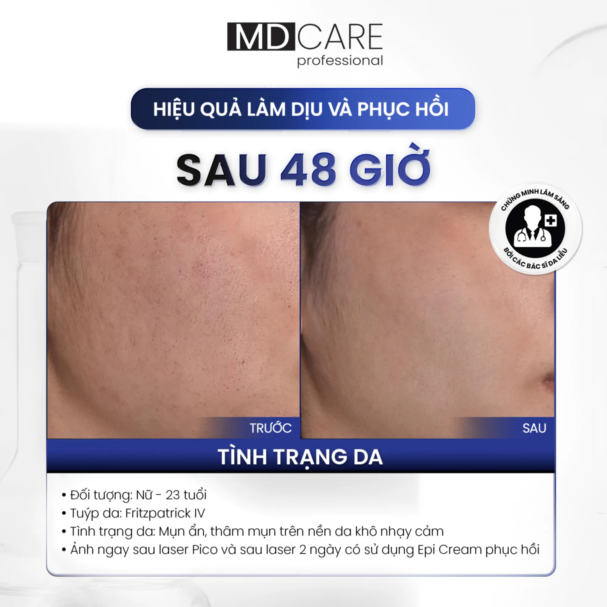 Kem Dưỡng Phục Hồi Và Cải Thiện Nếp Nhăn MD Care Epi-Procare Cream