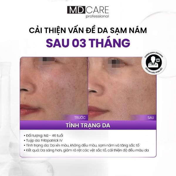 Kem Dưỡng MD Care A.R.T Brightening Complex