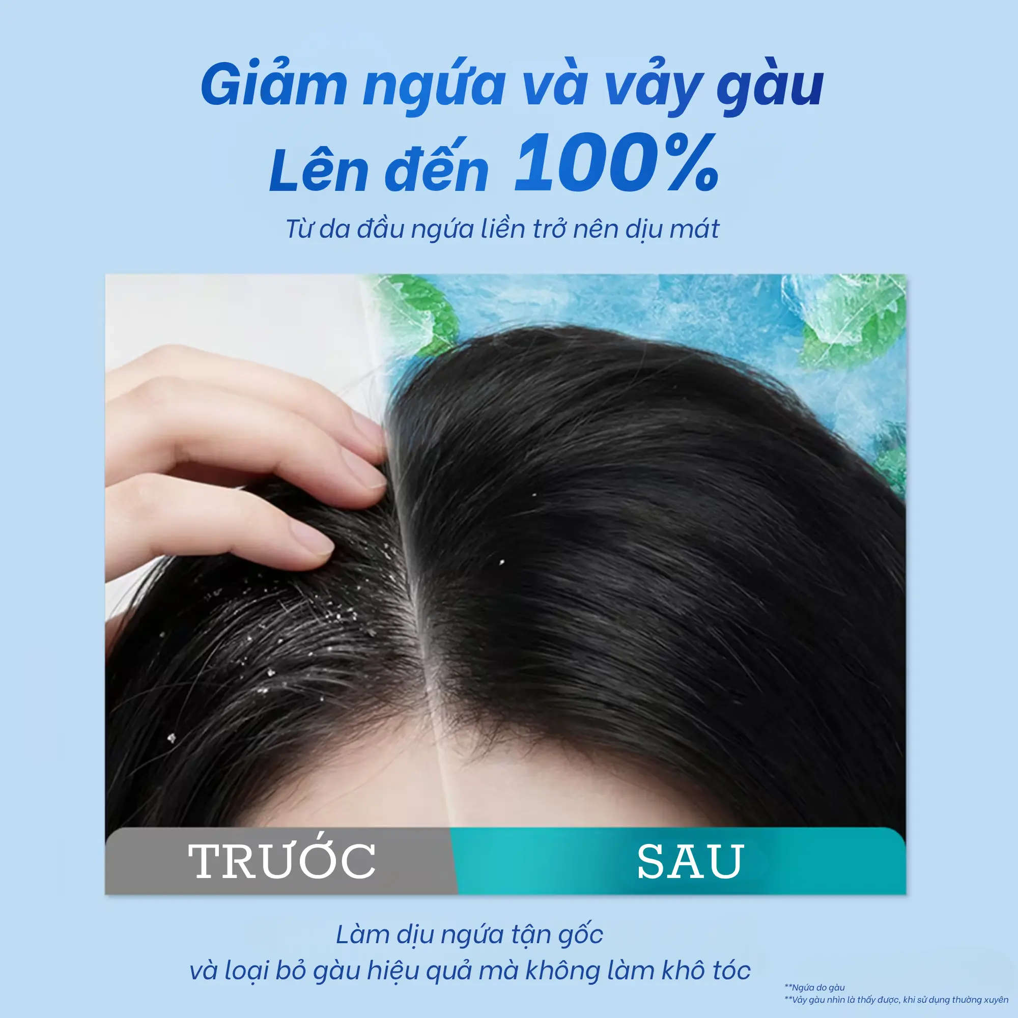 dầu gội head&shoulders giảm ngứa