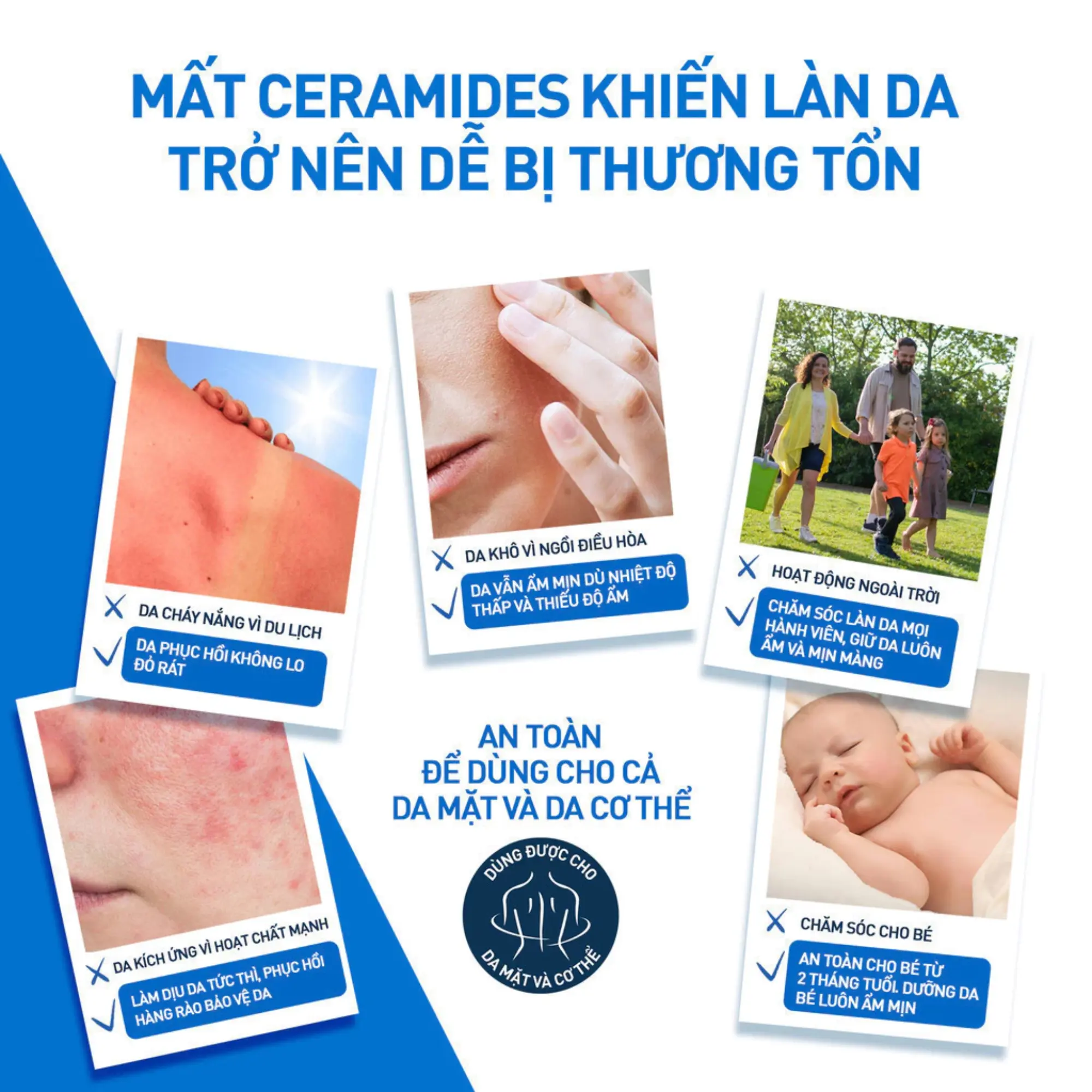 kem dưỡng cho da khô