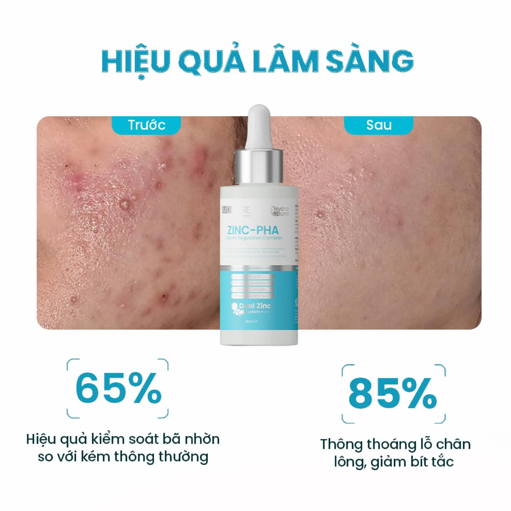 kem dưỡng mờ nám Angel's Liquid