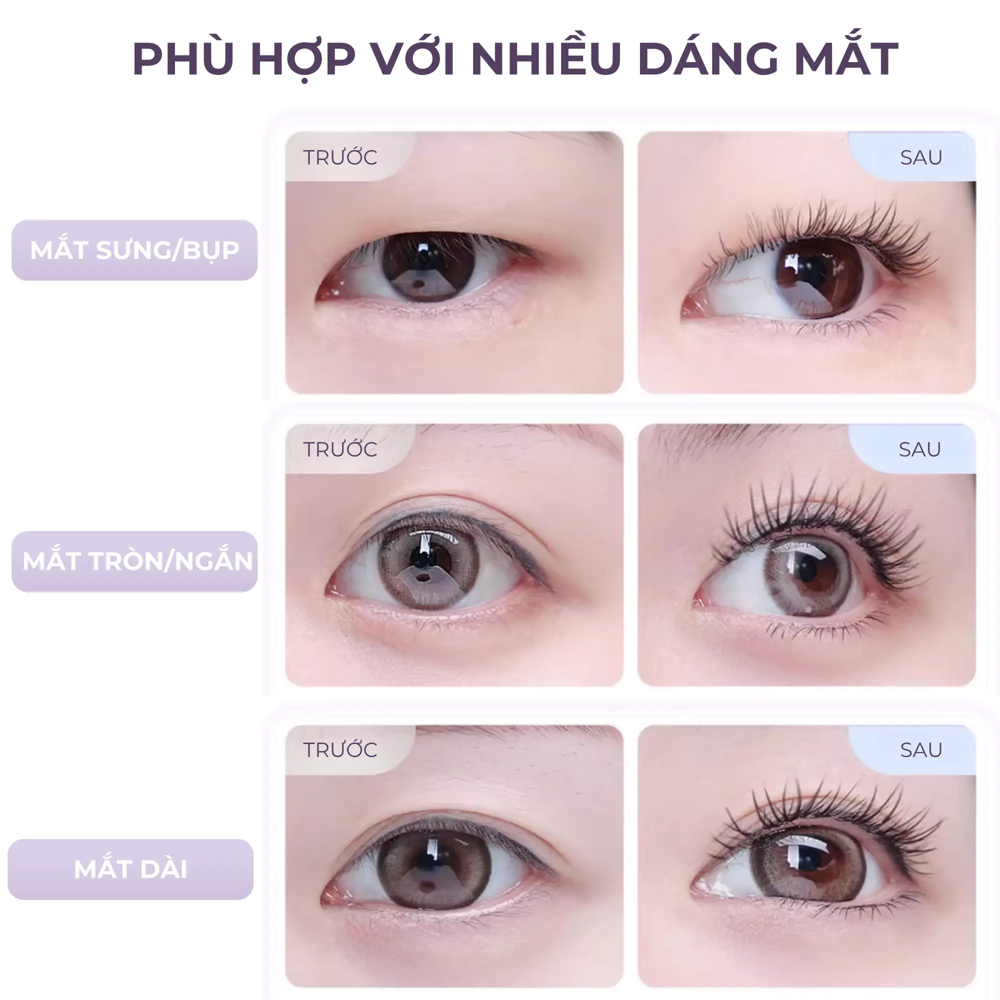 kẹp mi nhựa guoxiaoniu